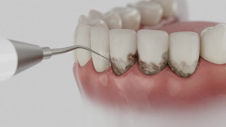 Reliable Emergency Dentist contractor in Kendall, FL by Smile Center Dentistry